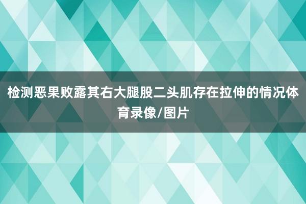 检测恶果败露其右大腿股二头肌存在拉伸的情况体育录像/图片